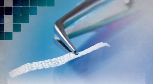 Ribbond Ribbon Fiber Splint