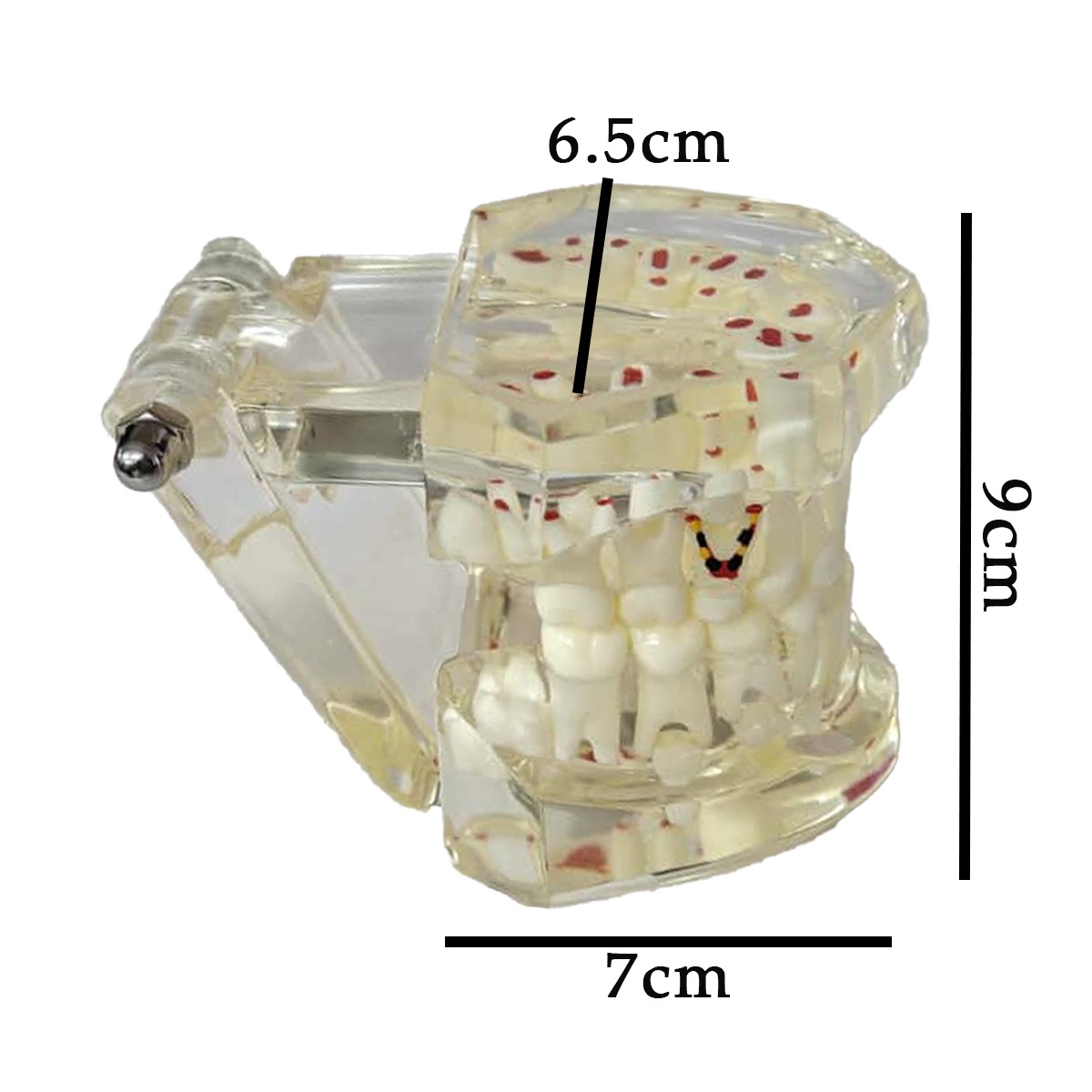 iDENTical Mixed Dentition Model M7015