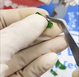 HN Dental Matrix Grip Matrix Holder - 5