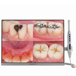 Waldent All-in-One PC Touch Screen Intraoral Camera