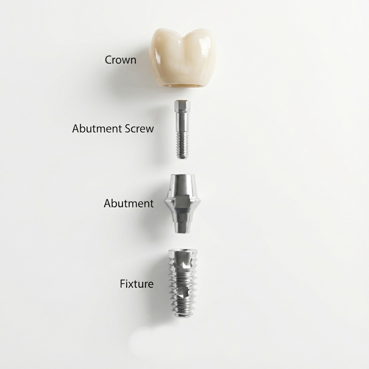 Mediden Nobel Active RP Compatible Titanium Abutment Screw (S-47)