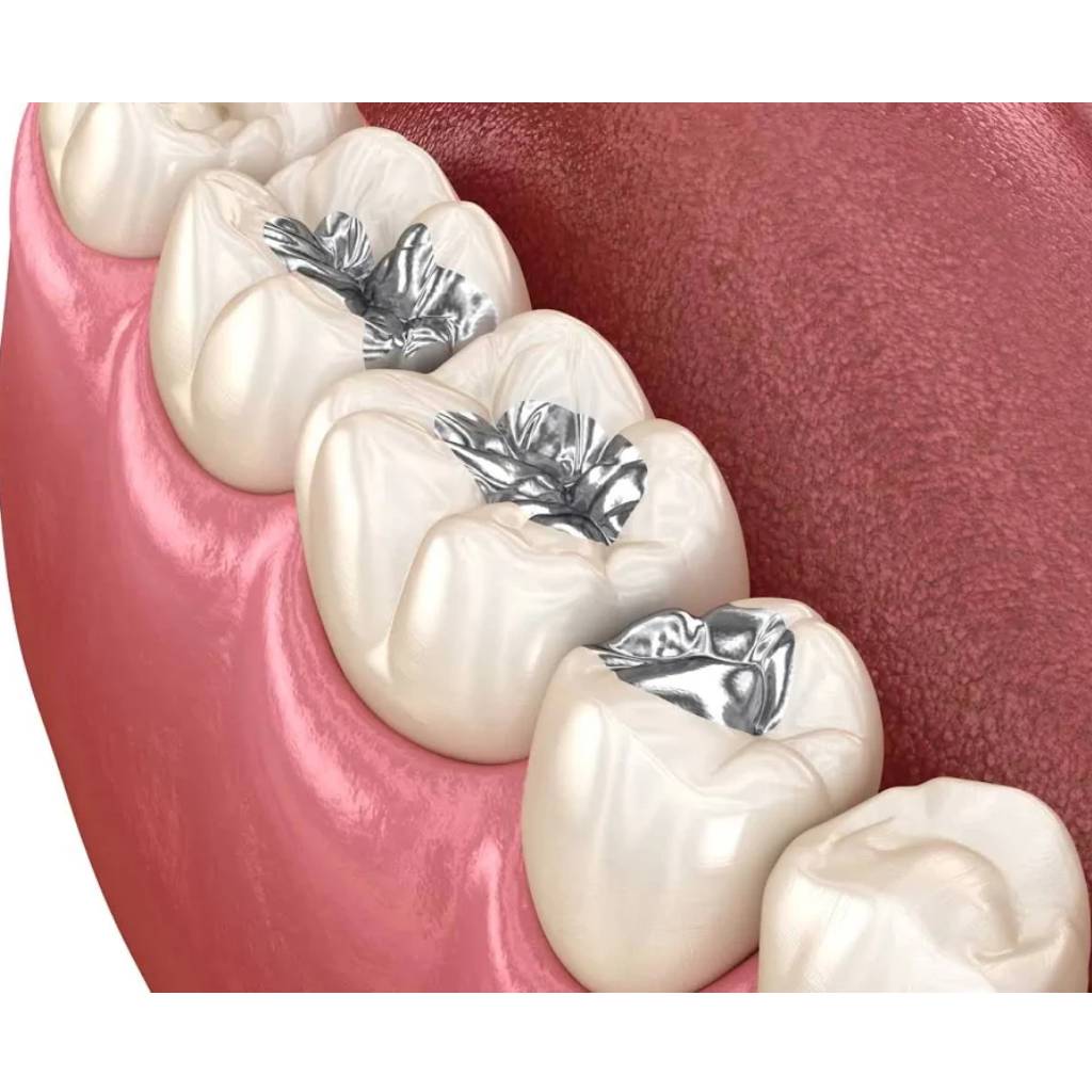 DPI Dental Silver Amalgam Powder 15g