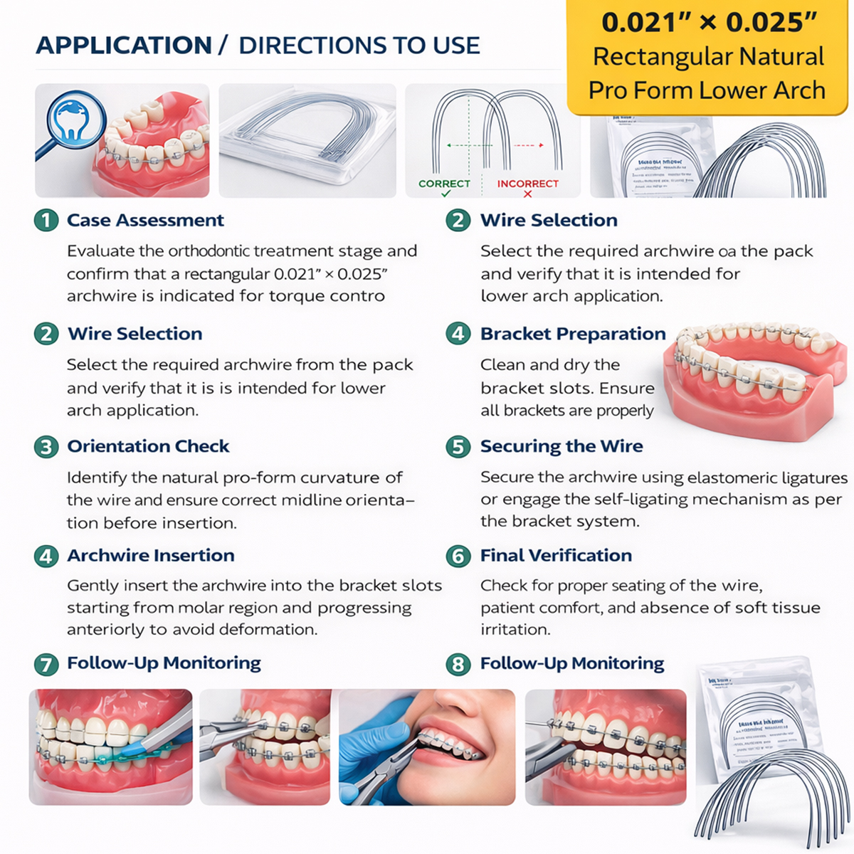 OrthoDent Titanium Molybdenum Archwires Natural / Pro Form Upper Rectangular 0.021"x 0.025" (Pack of 8)