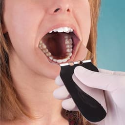 Dental Intraoral Photographic Mirrors - Adult Occlusal / Adult Buccal - 3