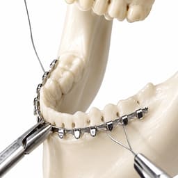GI Orthotec Erich Archbar (Pack of 10) - 4