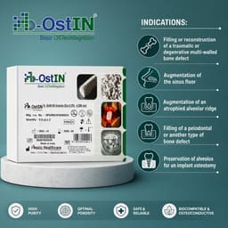 B-Osti