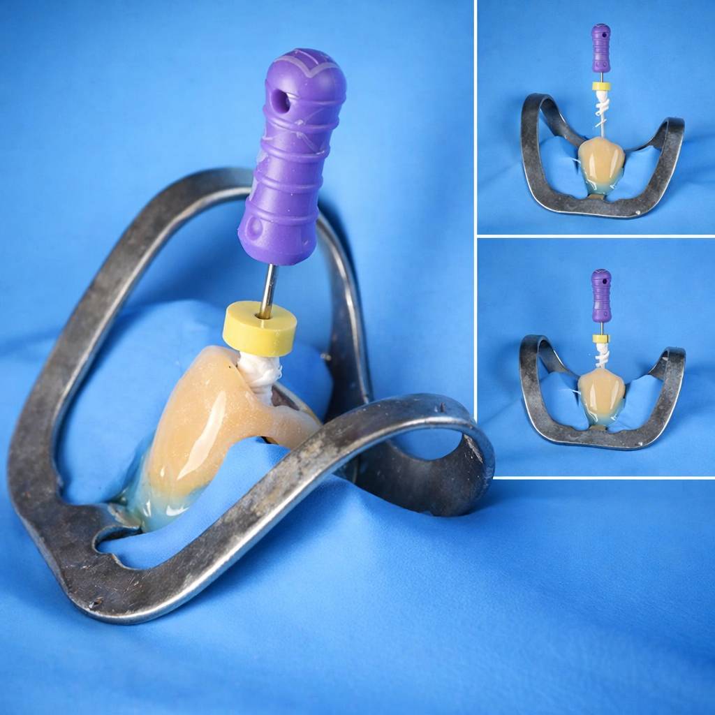 Waldent Brinker Rubber Dam Universal Clamp Adult | For Bicuspids & Incisors - B6 (16/151)