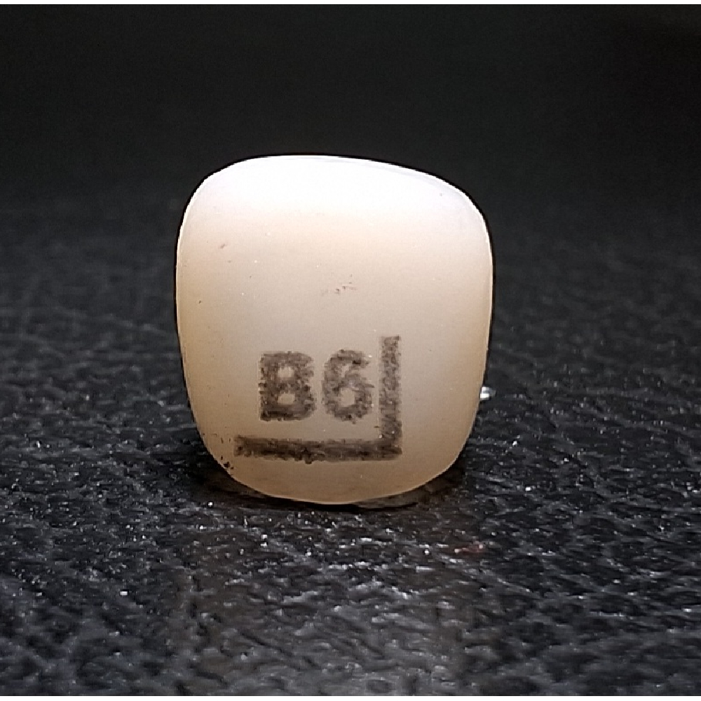 Pedo Crown Primary Upper Left Lateral Incisor Refill - Size B6