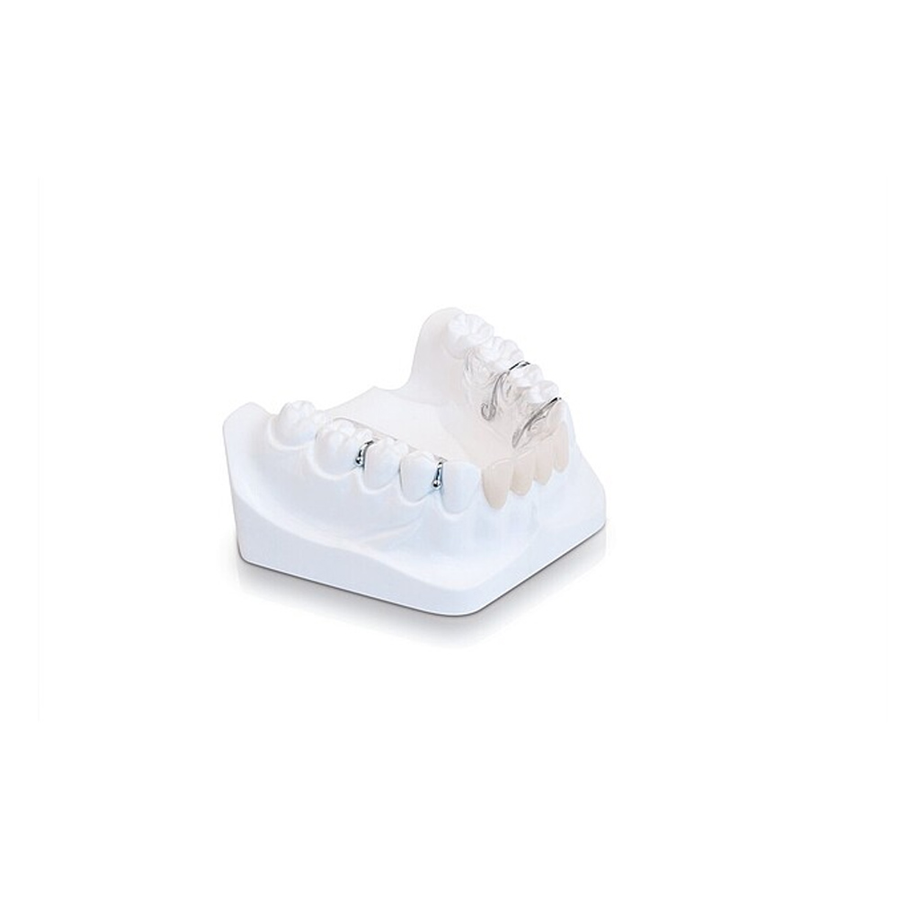 Scheu Biocryl "C" Rose- Transparent 2.0 x 125 mm 10/pk - 3152