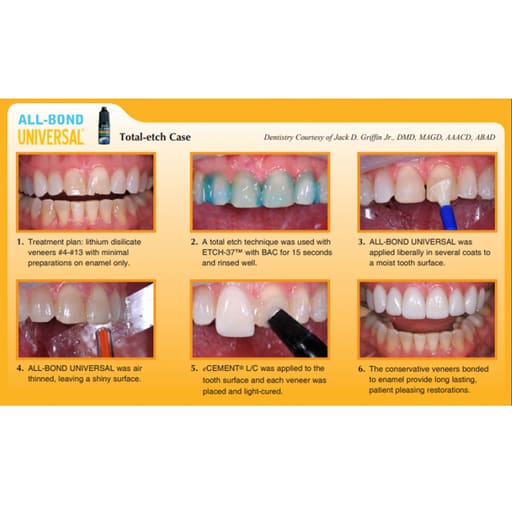 Bisco All Bond Universal LC Adhesive 4ml (Short Expiry 01-2027)