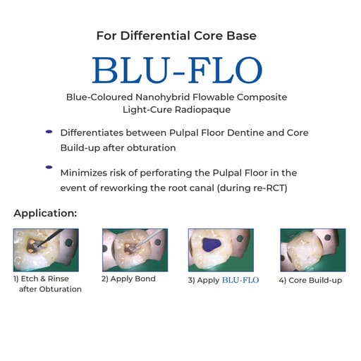 Anabond BLU-FLO Flowable Composite