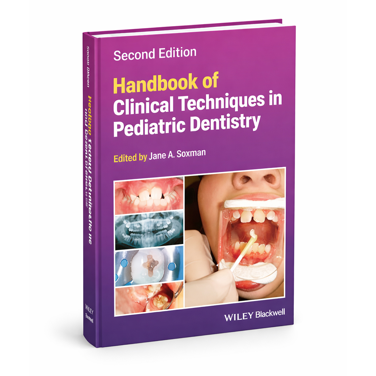 Handbook Of Clinical Techniques In Pediatric Dentistry 2nd Edition (ISBN - 661047)