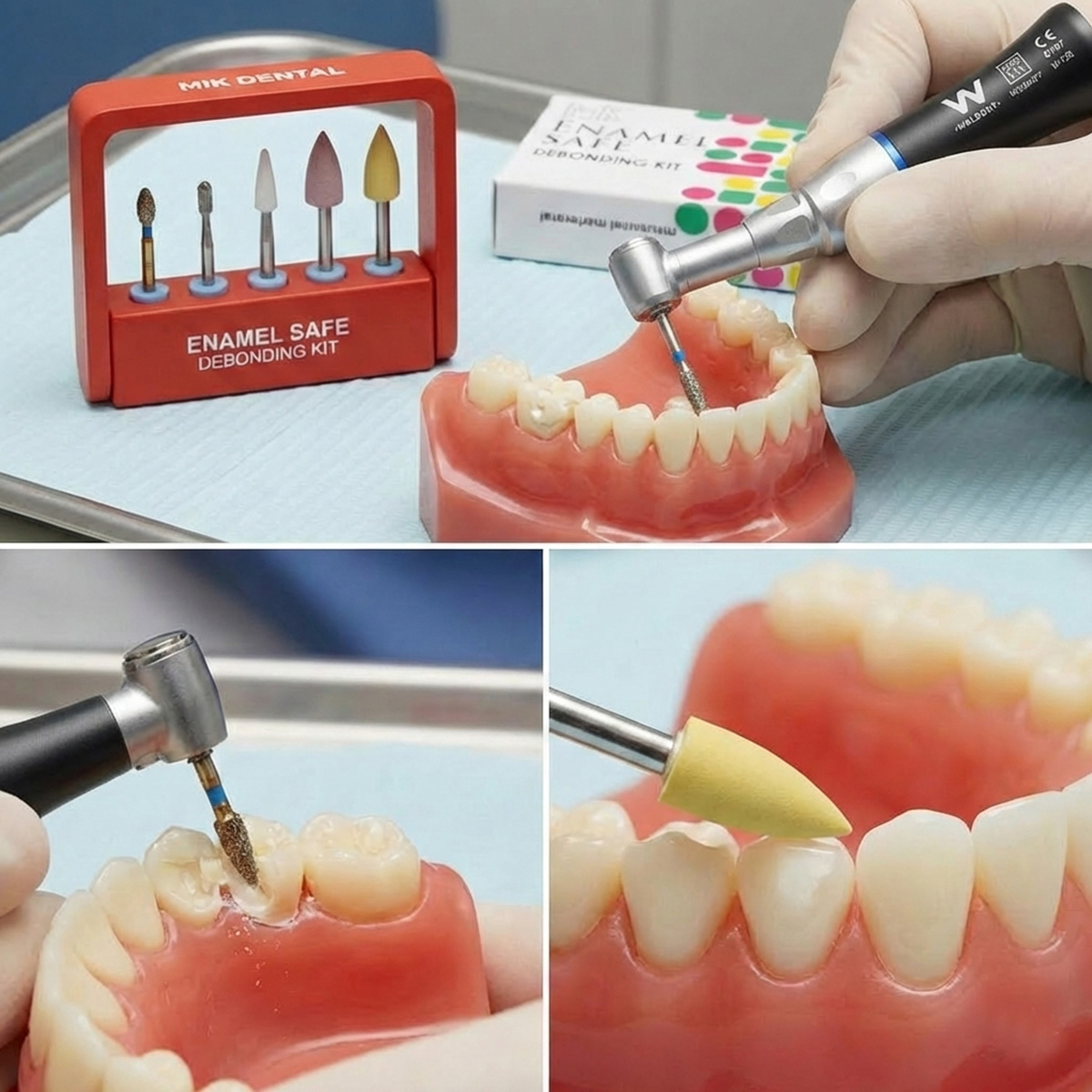 MIK EnamelSafe Ortho Debonding Bur Kit
