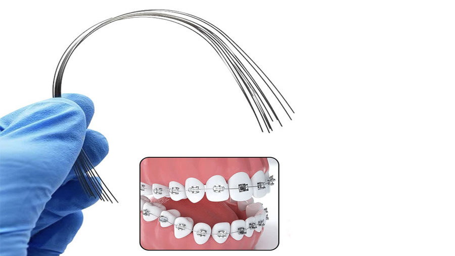 OSL Heat Activated NiTi Square Form Archwires - Square (Pack of 10)