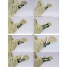 SK Surgicals SS Mini Bone Delta Plates - 2mm ( 300.501S) (Pack of 2  ) - 2