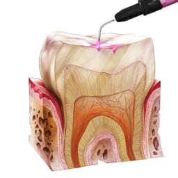DentAct Ultra Flow Colors Coloured Composite - 6