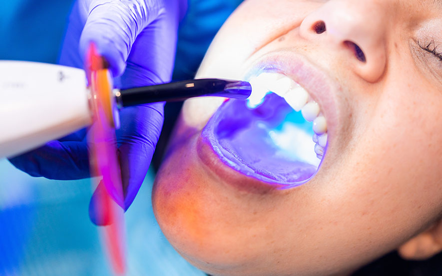 Medicept Xtracem-LC Shade - A2