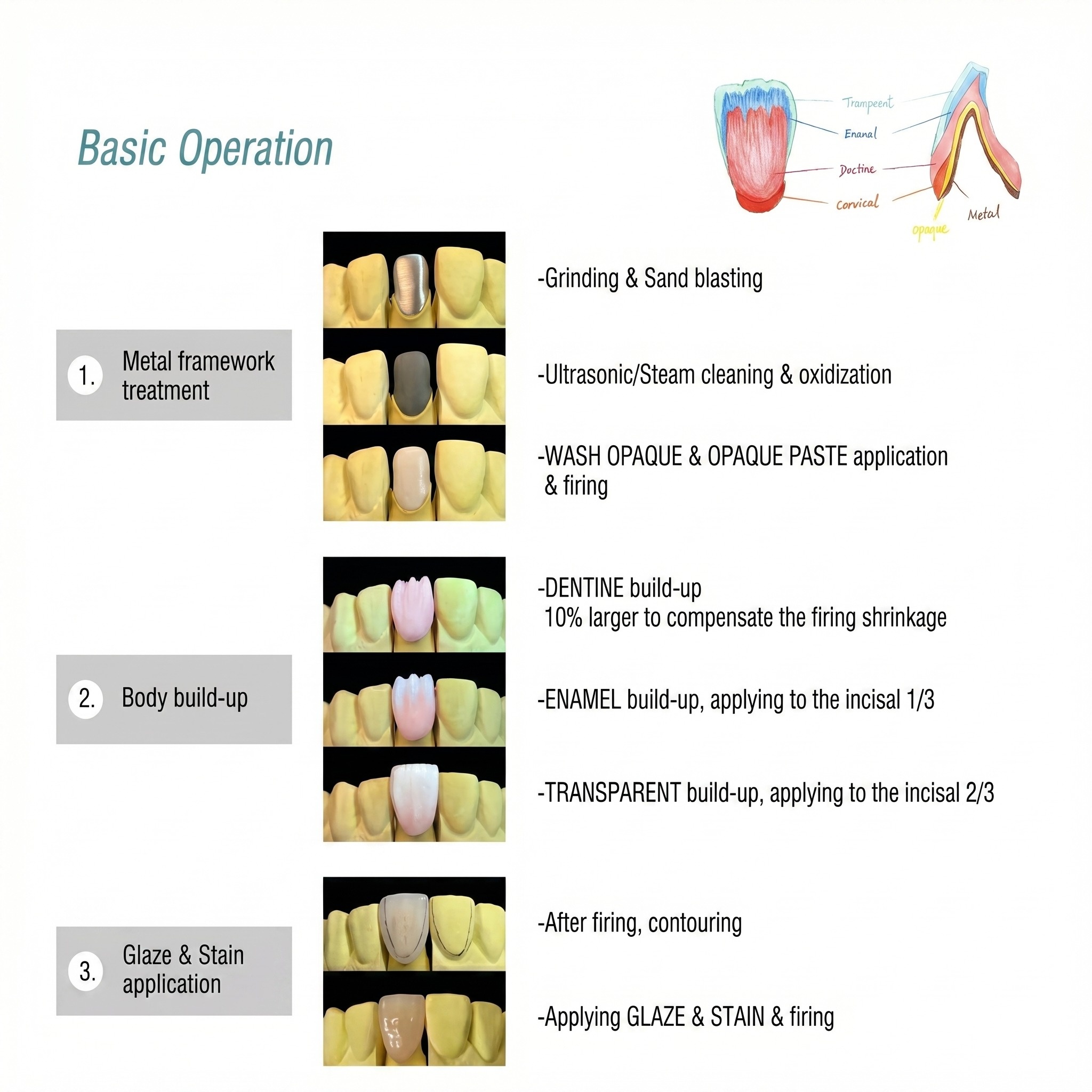 Baot JC Enamel - Metal Ceramic Series