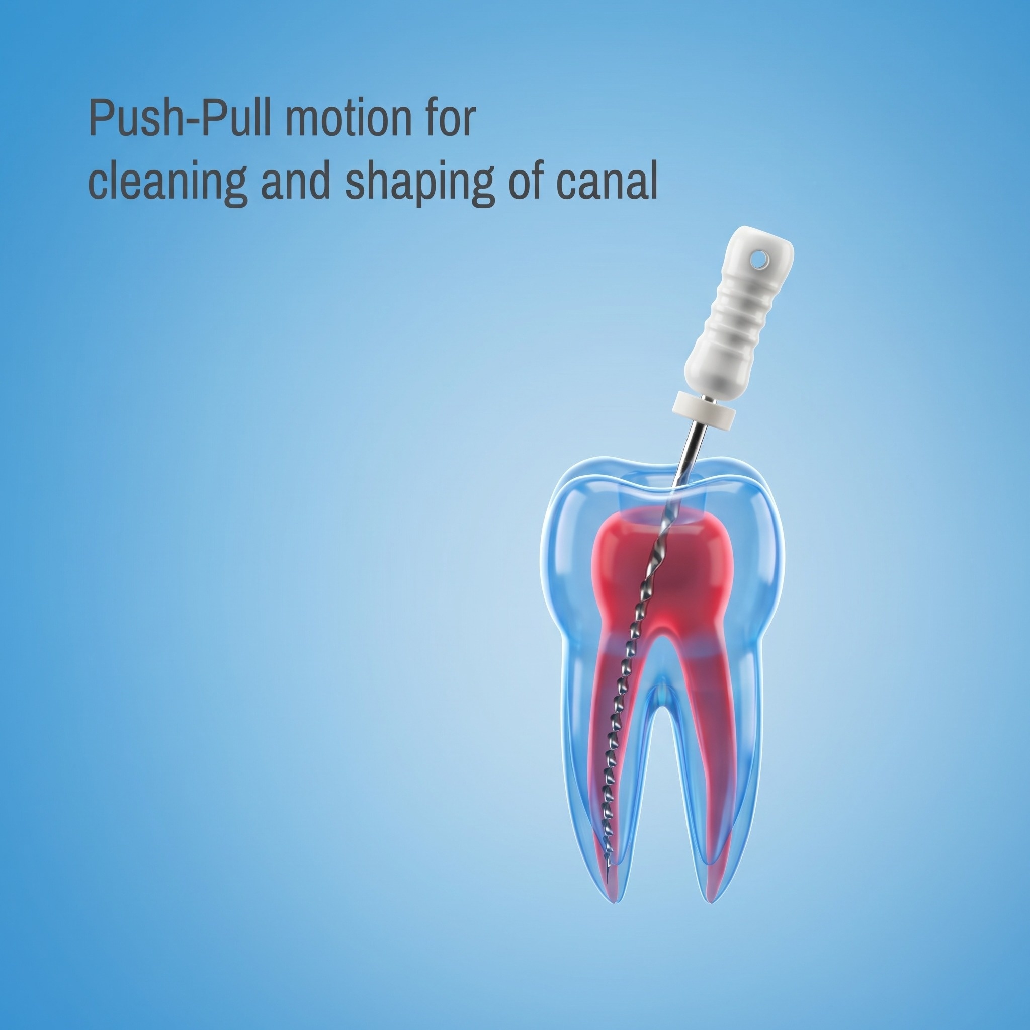 Waldent Professional H-File 21mm #15