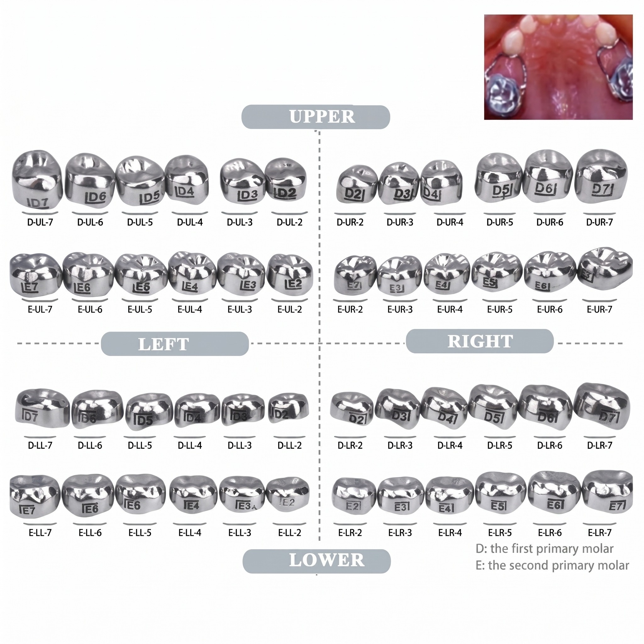 SuperEndo Stainless Steel Crowns Primary Molar Kit (Set Of 48)