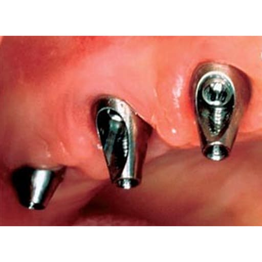 Dentaltech 25° Angular Abutment RS ∅4.7mm X G/H2.0mm - Adin | Noris | MIS | AB Dental Implant Compatible