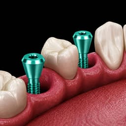Dentaltech Implant Cover Screw Regular ∅4.5mm X 0.4mm - Osstem | Dentium | DIO | Cowellmedi | Neobiotech | Dentis Compatible (GSCS40G) (Pack of 10) - 6