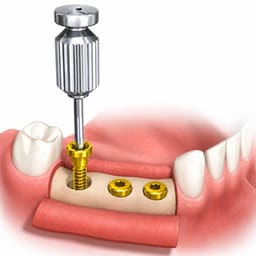 Dental