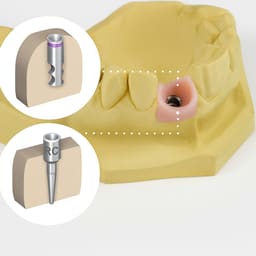 Dentaltech Lab Analog ∅4.0mm - Straumann RC Implant Compatible (ITI-RC 025.4101) (Pack of 10) - 6