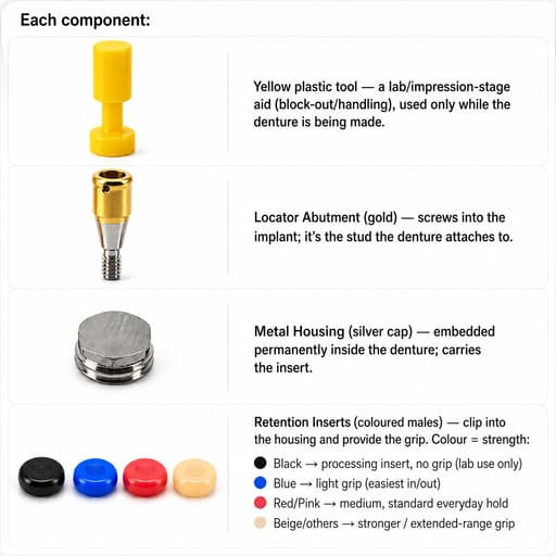 Dentaltech Locator Abutment Mini - Osstem Implant Compatible - Full Set