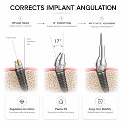 Dentaltech Multi Unit 17° Angular Abutments - Straumann RC Implant Compatible - 5