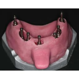 Dentaltech Open Tray Impression Copings - Nobel Biocare Implant Compatible - 6