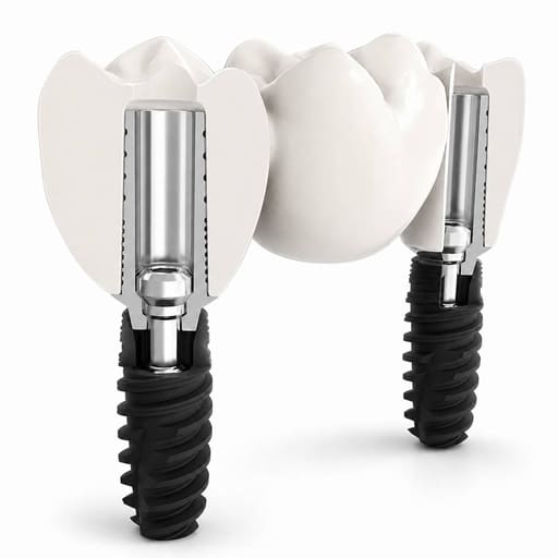 Dentaltech Straumann BLT Compatible Ti Base - NC - Non Hex