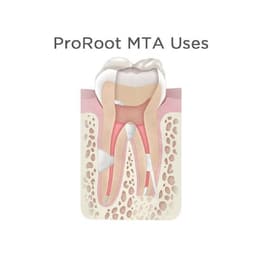 Dentsply Proroot MTA 0.5 Gm - 5
