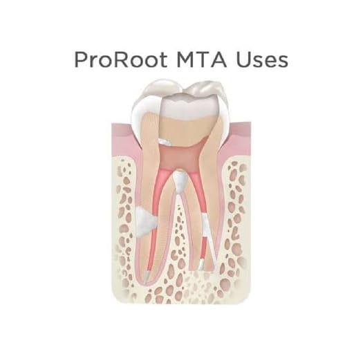 Dentsply Proroot MTA 0.5 Gm