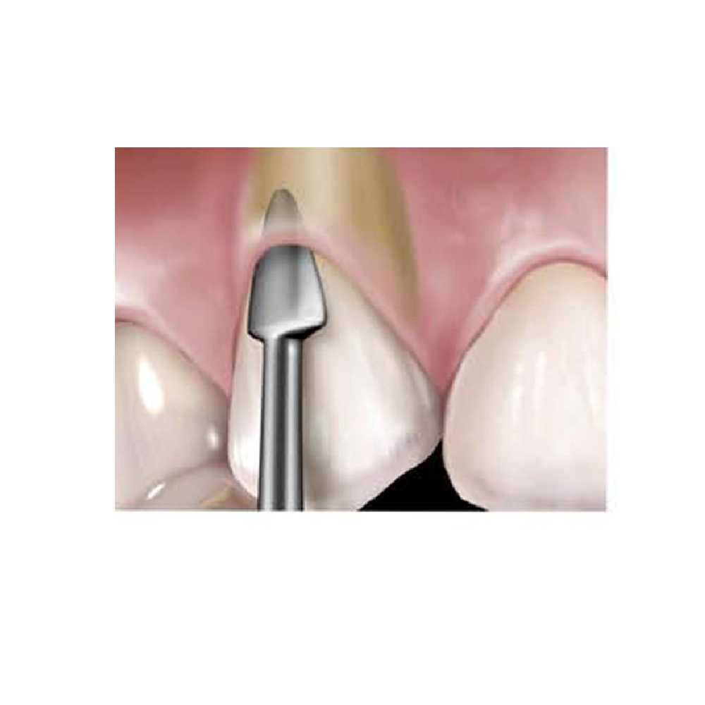 Gdc Proxitip-Luxating Hybrids Bernard Left (Eptber7)