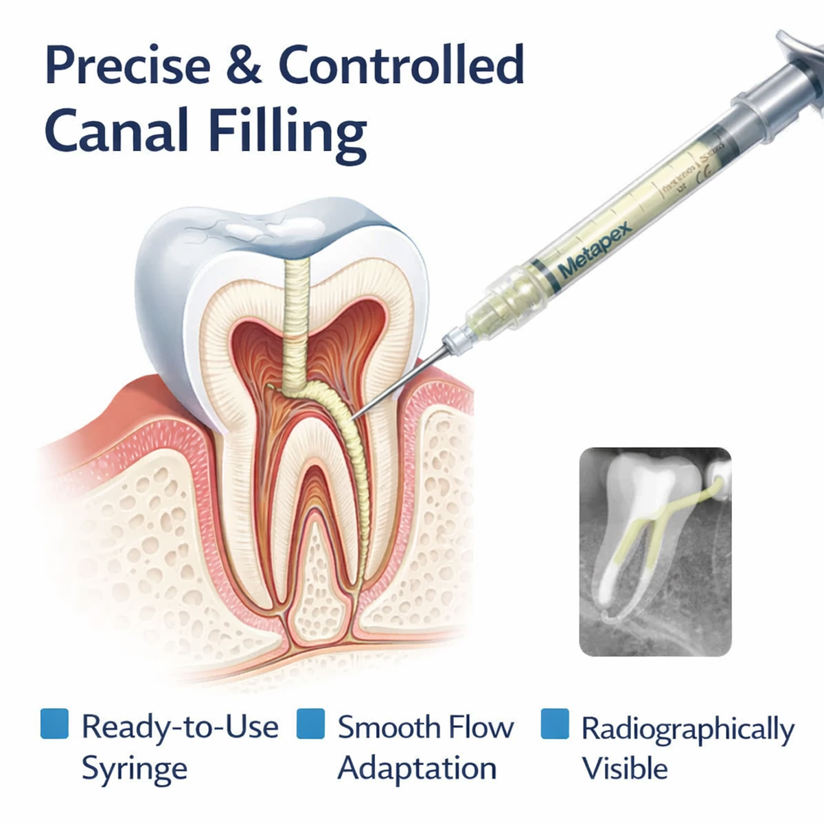 Meta Metapex Plus Double