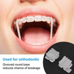 Ceramic Bracket Kit Roth 0.022 - 6