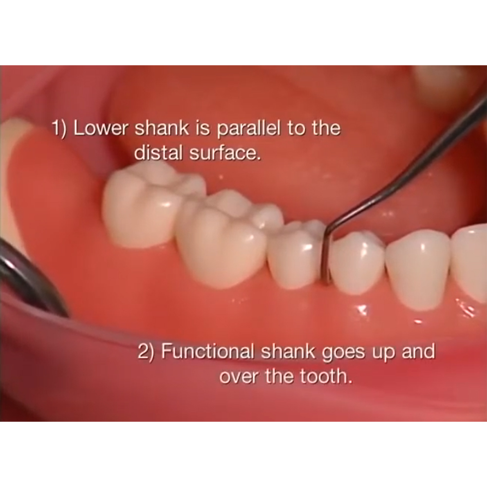 GDC Furcation Curette Quetin - Mesial/distal # 6 (SQMD2 # 6)