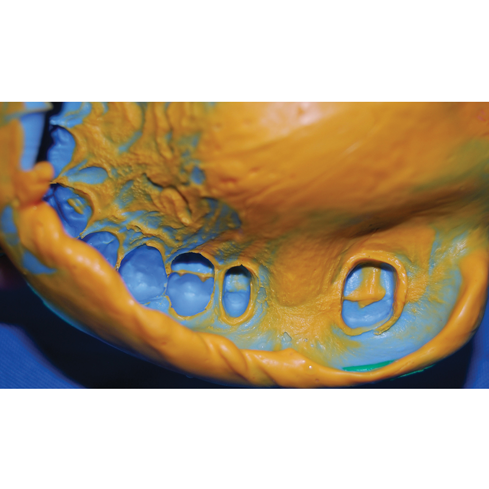 GC Flexceed Putty + Light Body Kit