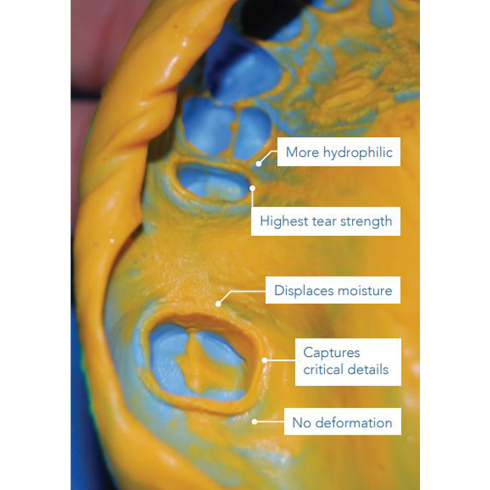 GC Flexceed Putty + Light Body Kit