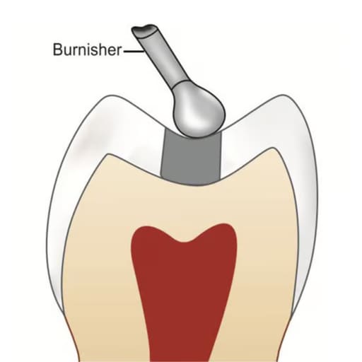 GDC Westcott Burnisher - 1 (Bb21)