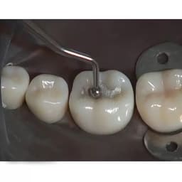 GDC Westcott Burnisher - 1 (Bb21) - 6