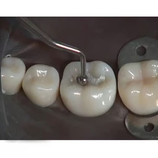 GDC Westcott Burnisher - 1 (Bb21)