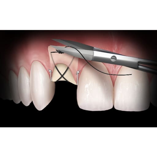 GDC Metzenbaum Tc # Straight (12Cm) S5054
