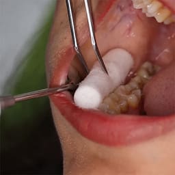GI Den