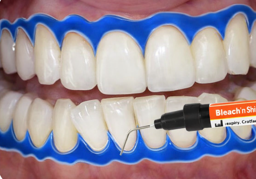 Mani Bleach'n Shine Gingiva Protector