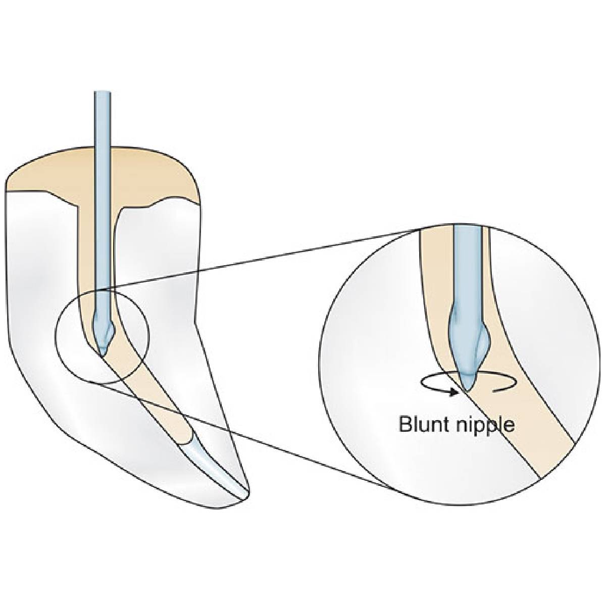 Mani Gates Drill 28Mm Assorted #1-6