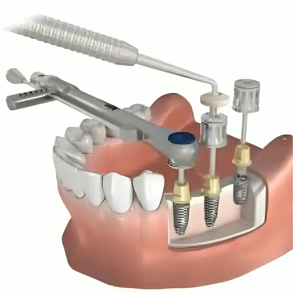Julldent Prosthetic Hex Drivers - Long (JULL-DENT 232)