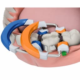HN Dental Master Matrix Complete Sectional Matrix System Kit - 2