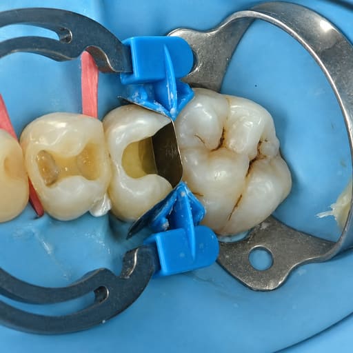 HN Dental Master Twin Force Complete Sectional Matrix System Kit